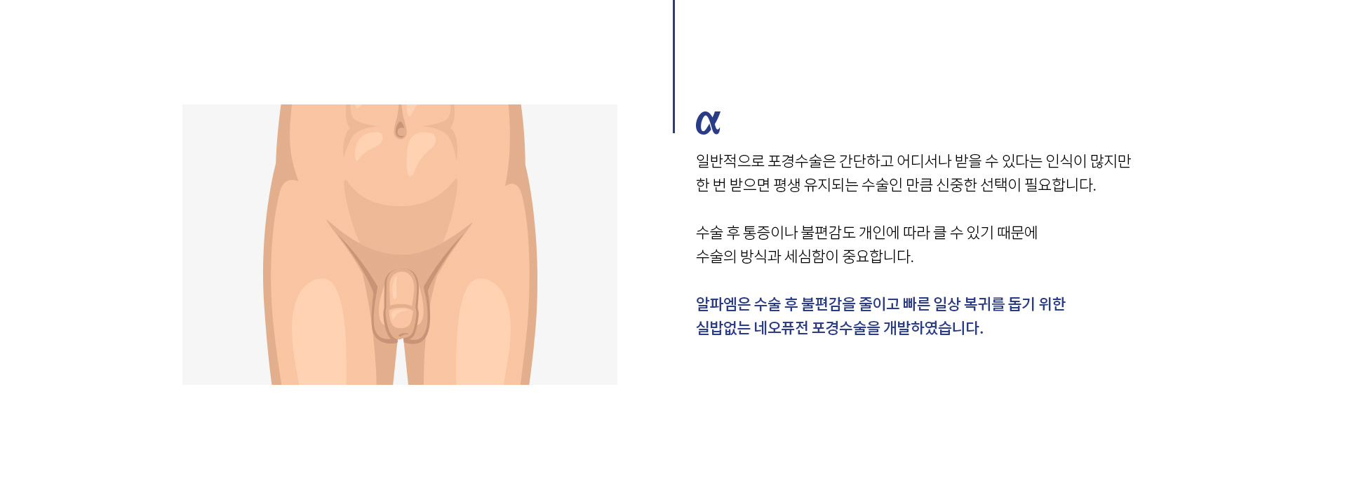 실밥없는포경수술 02